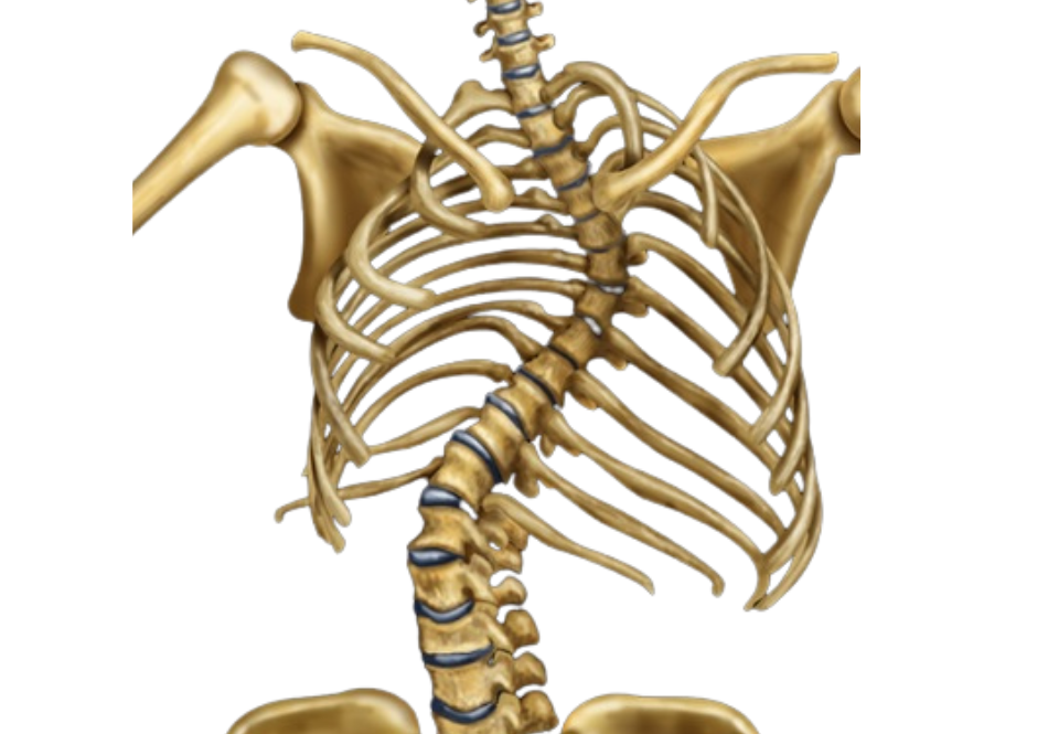 Cirurgia de Escoliose 